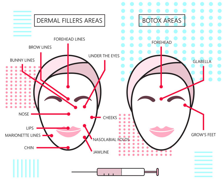 Botox & Dermal Filler Infographic